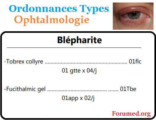 Blépharite cours d'ophtalmologie