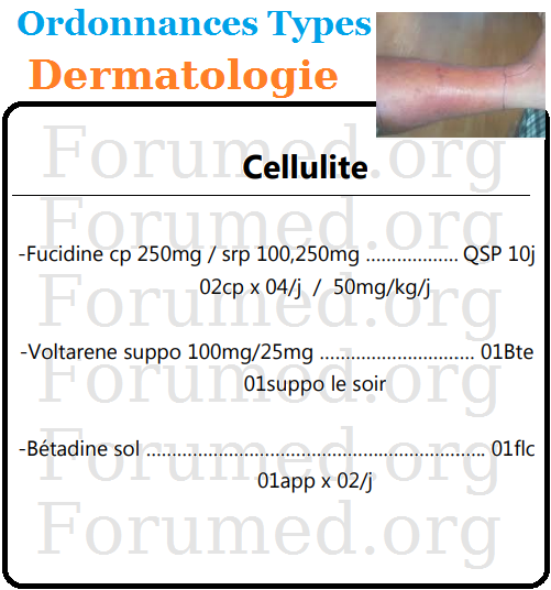 Cellulite infectieuse Ordonnance Type