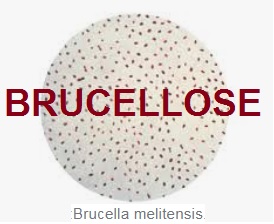 BRUCELLOSE =  Fièvre de Malte = Mélitococcie