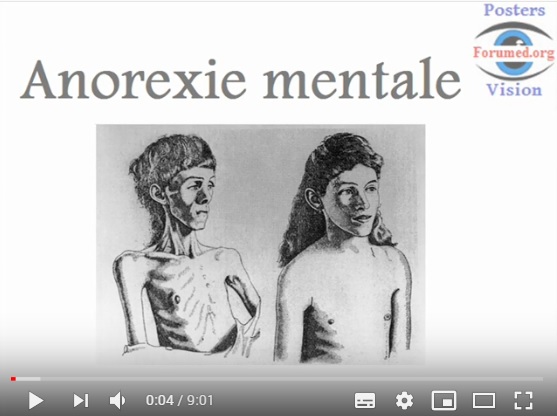 Anorexie mentale