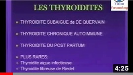 Thyroidites 