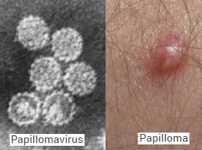 Les papillomavirus human papillomavirus HPV