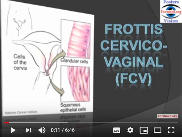 Frottis Cervico Vaginal interprétation