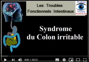 Syndrome du côlon irritable, le guide complet