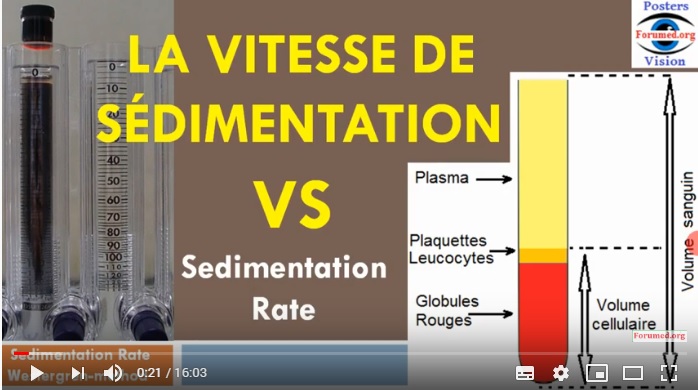 Methode Mesure de la vitesse de sedimentation rate VS ESR
