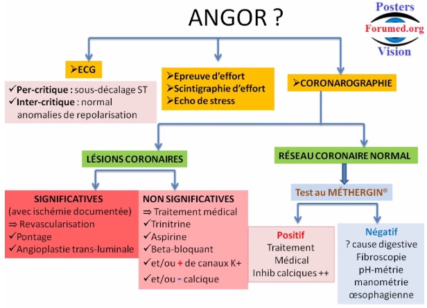 Orientation diagnostique devant ANGINE DE POITRINE ANGOR 