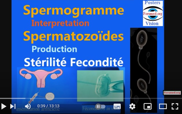 Interprétation du Spermogramme Production spermatozoïdes Stérilité infertilité fécondité homme 