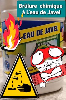 Brûlure chimique à L'eau de Javel