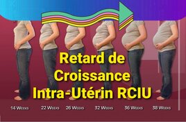 Retard de Croissance Intra-Utérin RCIU